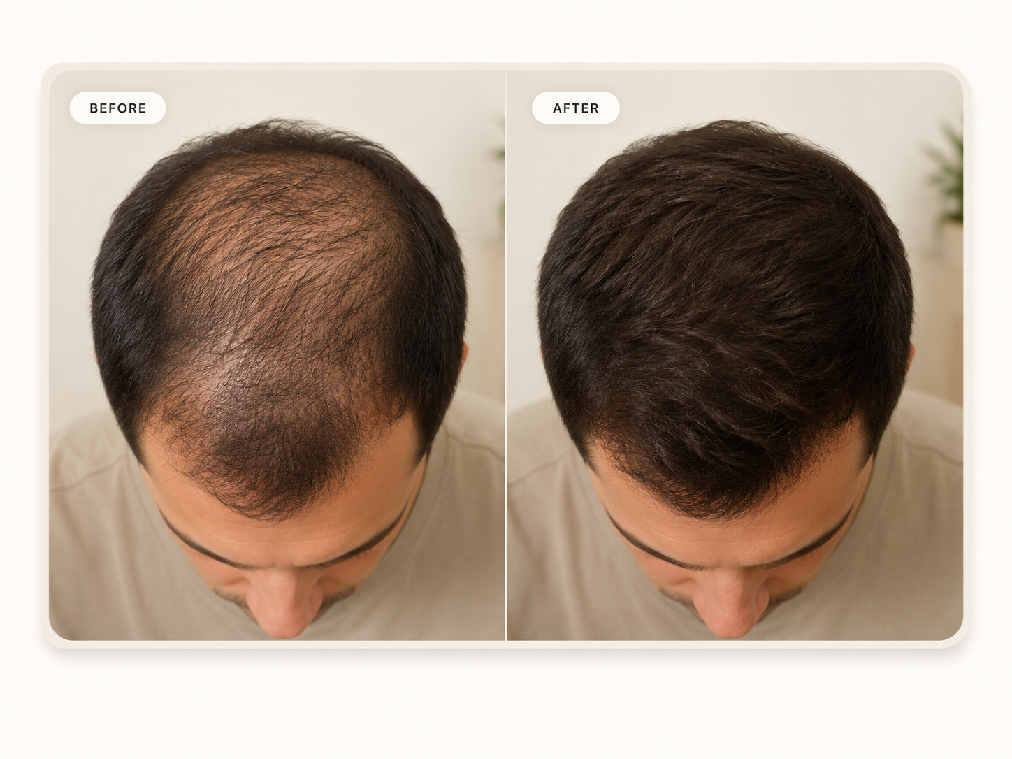 Customer result image after clinician-reviewed plan