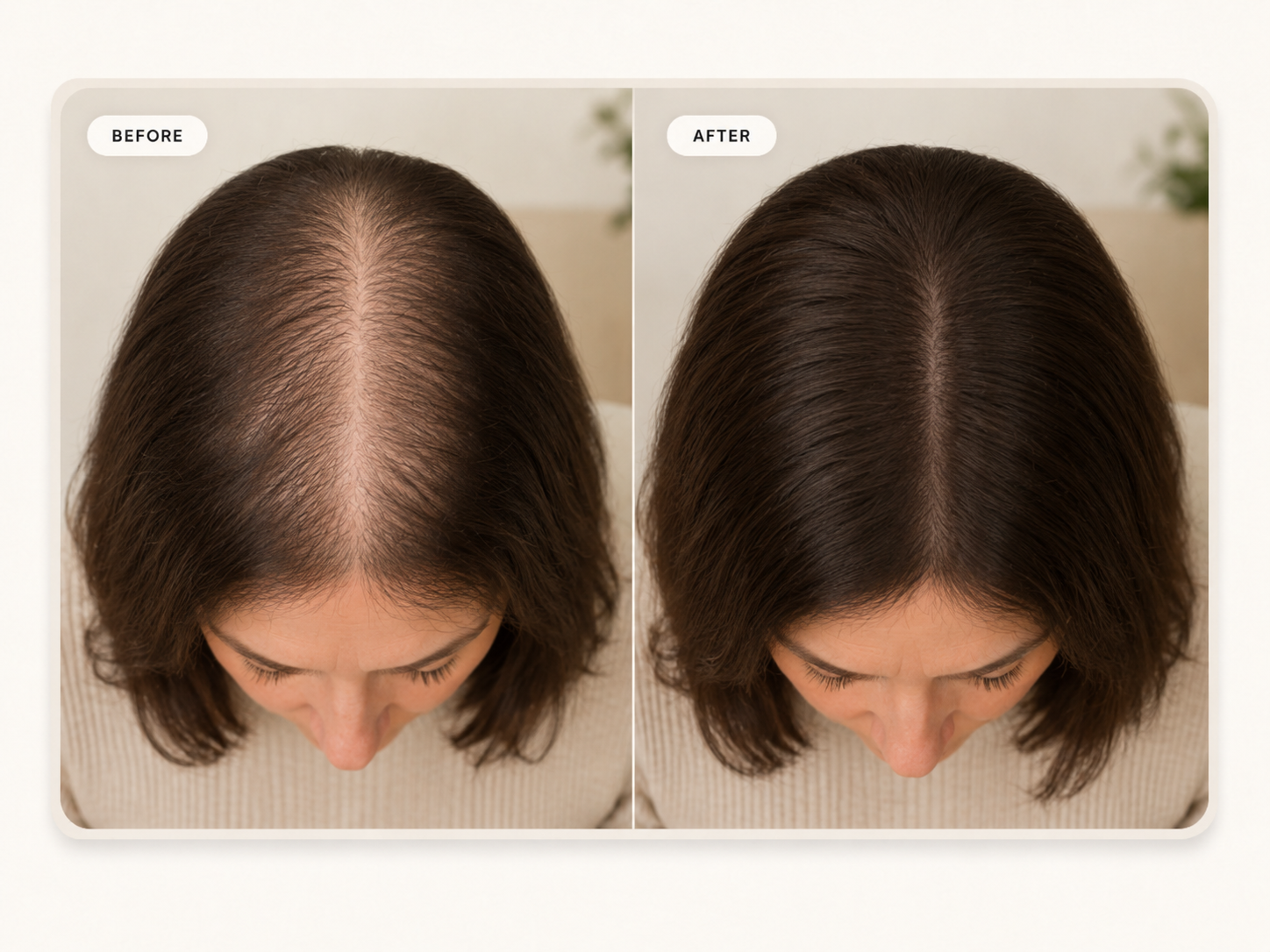 Customer result image before clinician-reviewed plan