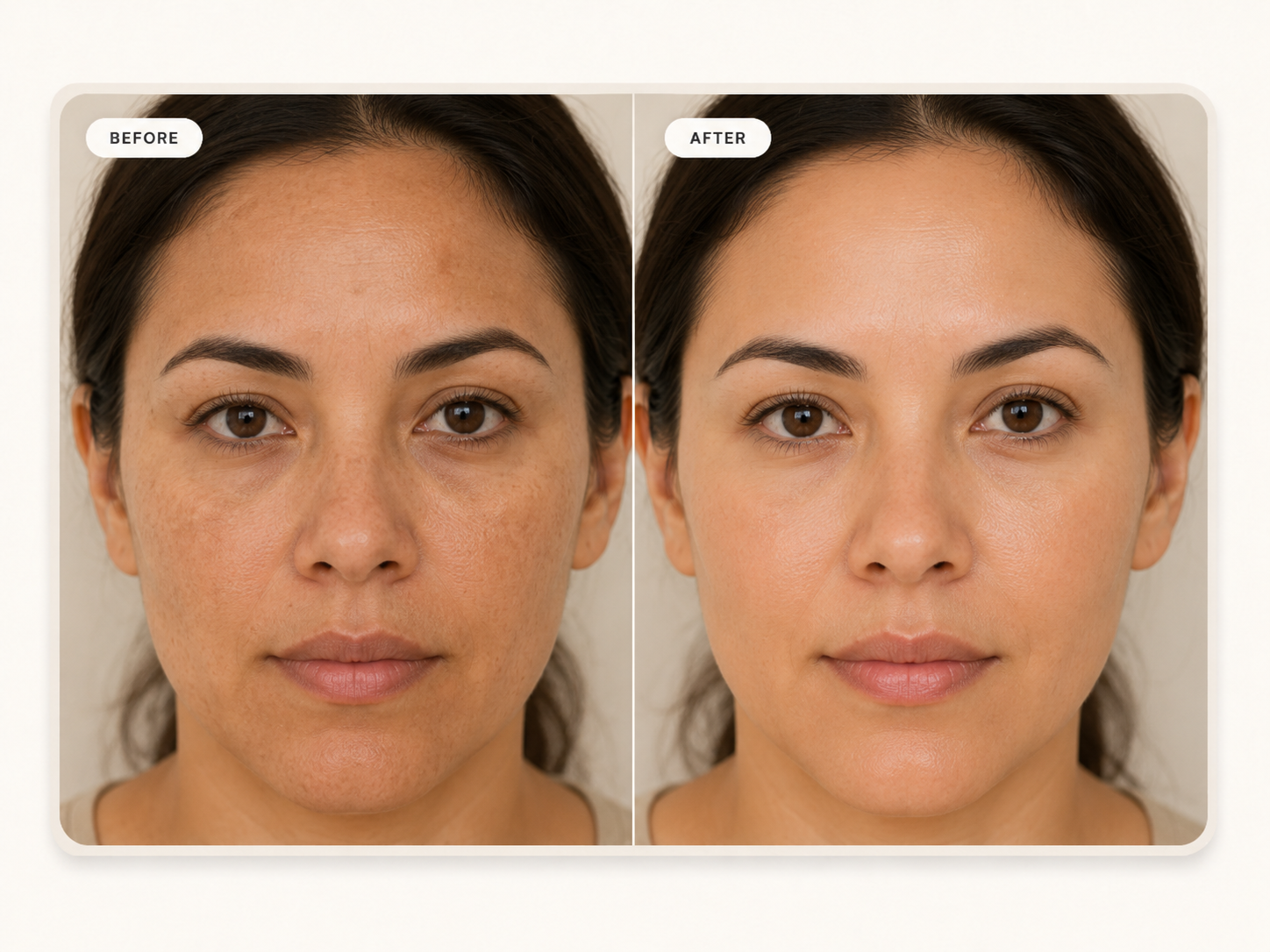 Customer result image before personalised treatment